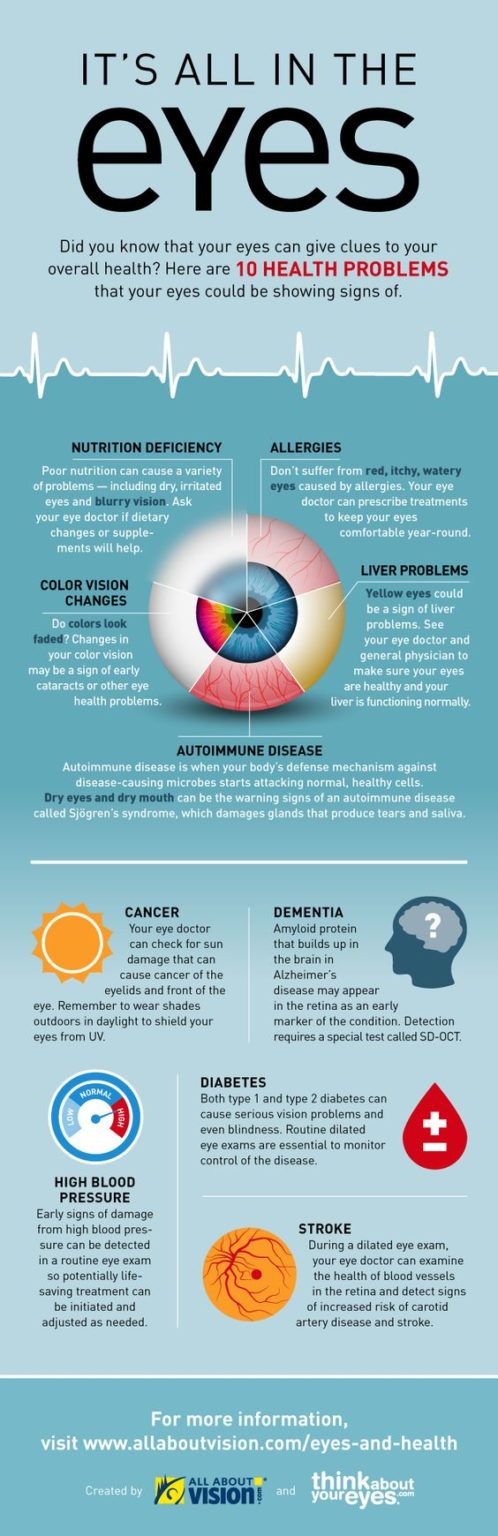 How an Eye Exam Helps With Your Overall Health: INFOGRAPHIC – Metro Eye